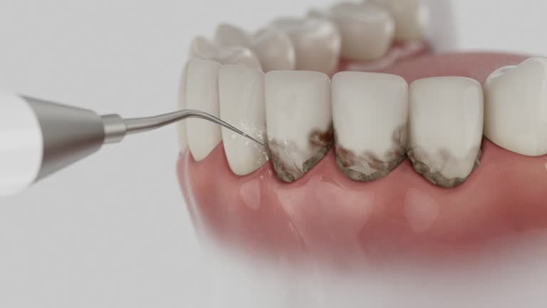 Reliable Dental Implants contractor in Covington, LA by Smile Center Dentistry